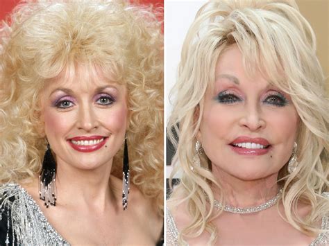 Dolly Parton Then And Now