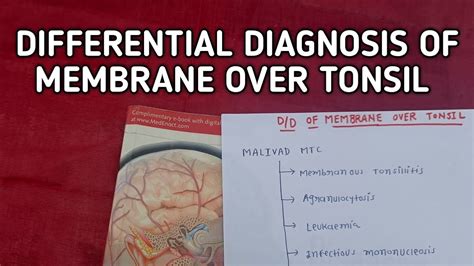 Differential Diagnosis Of Membrane Over Tonsil Ent Youtube