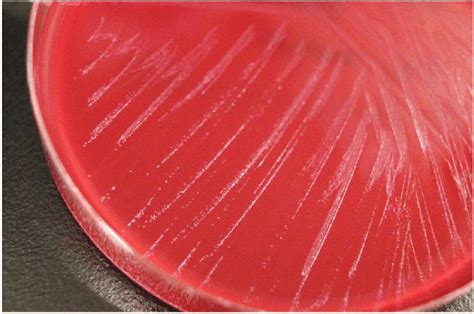 Colony Morphology Of The Present Strain On Brucella Hk Agar Plate