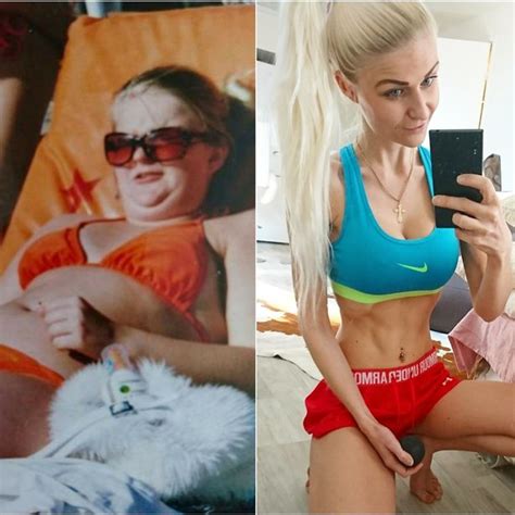 Model Who Battled Anorexia And Obesity After Being Bullied By Her Own