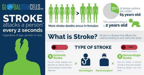Stroke Symptoms Improve Dramatically With Stem Cell Therapy Gsc
