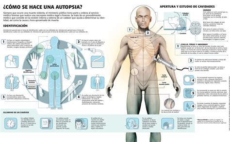 Síntesis De 18 Artículos Como Se Hace La Autopsia De Un Cuerpo Actualizado Recientemente