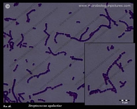 Streptococcus Agalactiae Gram Stain