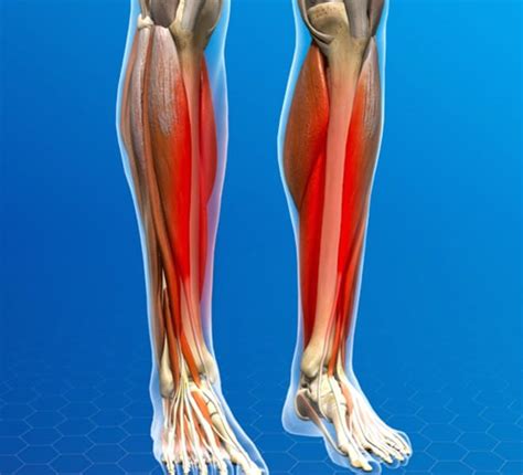 How Do Shin Splints Happen Exercises To Improve Shin Splints At Dpt