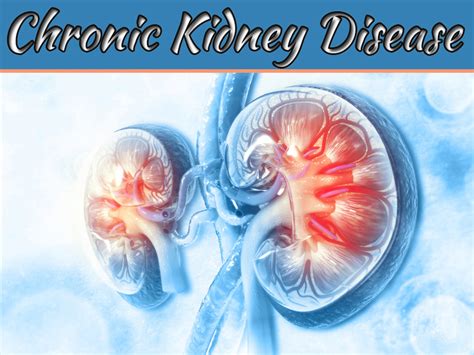 Chronic Kidney Disease Ckd 99 Health Ideas