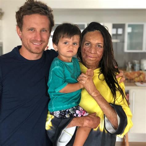 Turia Pitt Gives Birth To Baby Boy Rahiti With Fiance Michael Hoskin News Com Au Australias