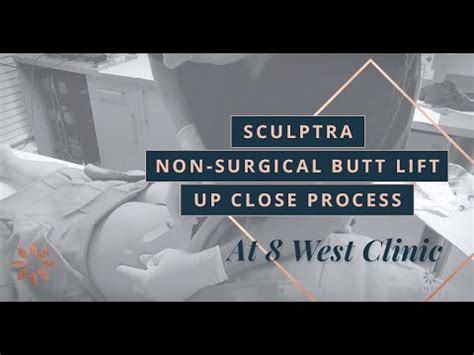 Sculptra Non Surgical Butt Lift Treatment In Vancouver B C At West