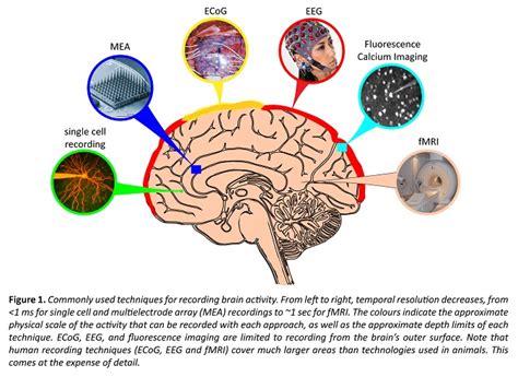 How Does Fmri Work In The Study Of Brain Activity Study Poster