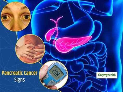 Pancreatic Cancer Symptoms Pancreatic Cancer 16 Warning Signs You