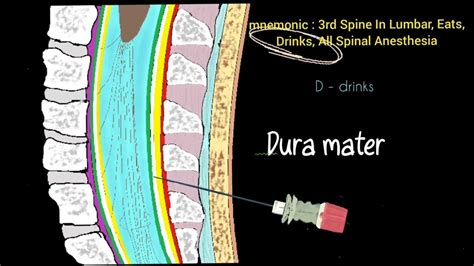 Mnemonic For Lumbar Puncture Spinal Anesthesia Layers Youtube