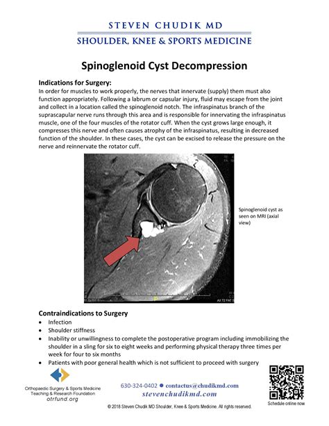 Arthroscopic Spinoglenoid Cyst Decompression Steven Chudik Md