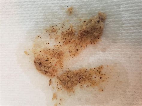 Vomiting in cats differs from regurgitation. Is this blood in cat vomit? I've read it looks like coffee ...