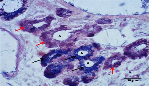 Magnified Section For Alveoli Of Jacobsons Glands Shows Two Types Of