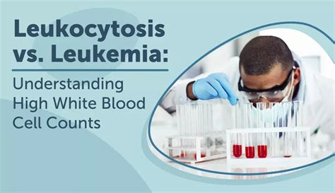 Leukocytosis Vs Leukemia Understanding High White Blood Cell Counts