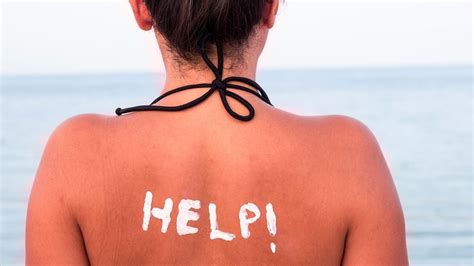The Best Ways To Treat A Sunburn According To Dermatologists 😡 It