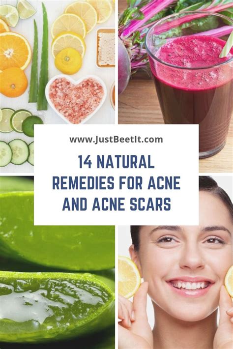 14 Easy And Natural Remedies To Remove Acne And Acne Scars — Just Beet It