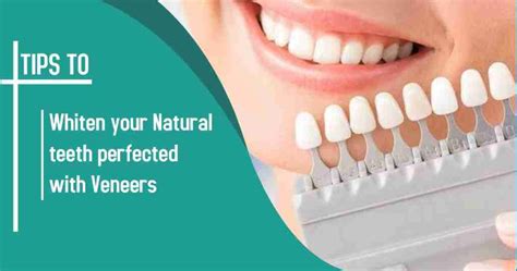 Dental Veneers And Teeth Whitening Do They Go Hand In Hand Cumbria Smiles