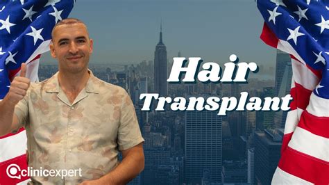 Hair Transplant Mr Rashad Choose Clinicexpert Best Hair Transplant