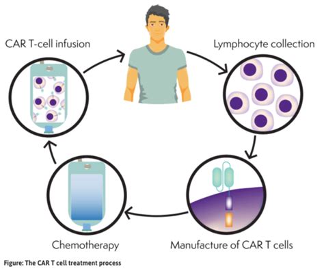 Chimeric Antigen Receptor Car T Cell Therapy Lymphoma Australia