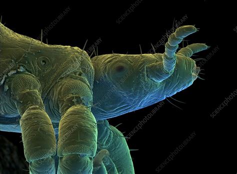 Coloured Sem Of A Human Body Louse Pediculus Stock Image Z