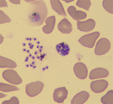 Ucr Newsroom How The Malaria Parasite Spreads In Red Blood Cells