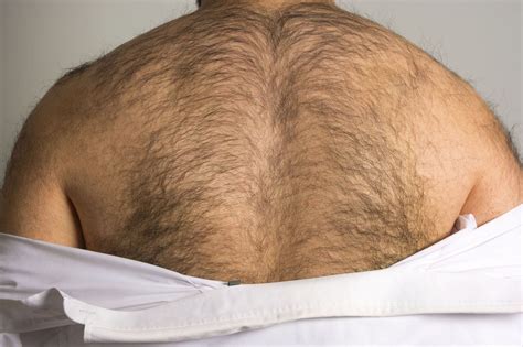 Back Hair Removal Laser Hair Removal For The Back