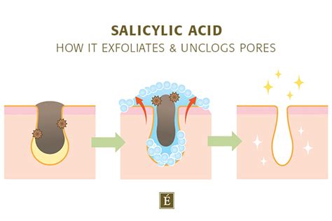 How Does Salicylic Acid Clear Acne Eminence Organic Skin Care