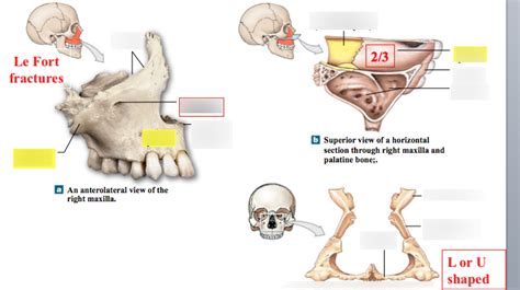 Week 3 Facial Bones Maxillae And Palatine Diagram Quizlet
