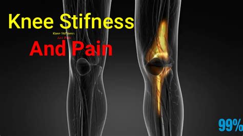 Knee Stiffness And Pain Causes And Treatment Youtube