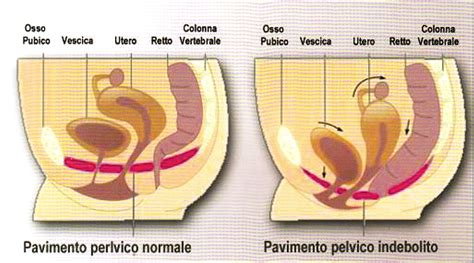 Incontinenza Urinaria E Urodinamica Ginecologo Dr Salvatore Di Leo