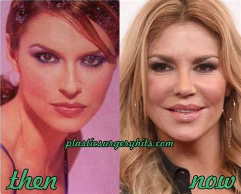 Brandi Glanville Plastic Surgery Before And After Plastic Surgery