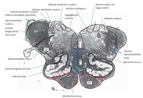 Transverse View Of Medulla Oblongata In Posterior Fossa Neuroanatomy