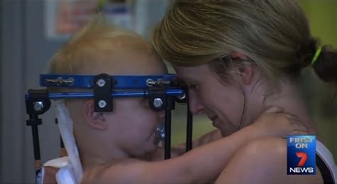 Toddler Has Head Reattached In Miracle Surgery