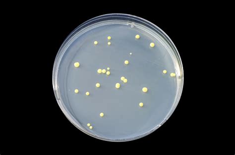 Las Colonias De Bacterias Micrococcus Luteus En El Agar De Soya