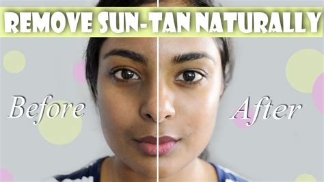 How To Remove Suntan And Hyperpigmentation Naturally For Even Skin Tone