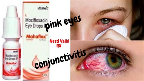 Mahaflox Eye Drops Review Conjunctivitispinkeye Symptoms Andtreatment