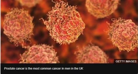 Prostate Cancer Deaths Overtake Those From Breast Cancer Uk