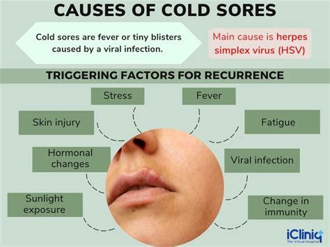 Cold Sores Causes Symptoms Risk Factors Diagnosis Treatment