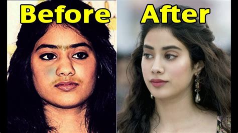 Jhanvi Kapoor Shocking Transformation Photos Before And After Surgery
