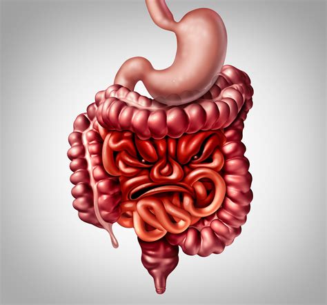 What Is Ibs Irritable Bowel Syndrome Ibs