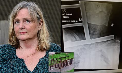 Retired Nurse Has Brush With Death After Tripping Up And Impaling Her