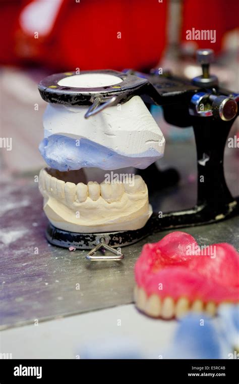 Fabrication Of Complete Dentures Stock Photo Alamy