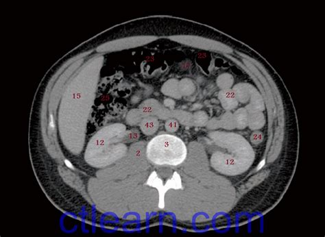 Learn Ct Scan Anatomy Ct Axial Abdomen And Pelvis Male