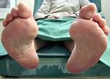 Foot Doctor Ontario Images
