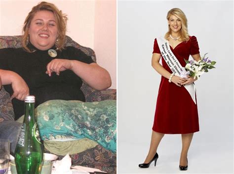 Slimmers Of The Year Before And After Pictures Of The Winners