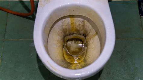What Causes Grey Stains In A Toilet Bowl Tricks To Remove