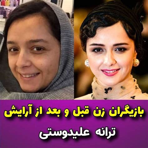 عکس از 10 خانم بازیگر زن بدون آرایش مقایسه قبل و بعد