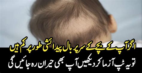 اگر آپ کے بچے کے سر پر بال پیدائشی طور پر کم ہیں ۔۔ تو یہ ٹپ آزما کر دیکھیں آپ بھی حیران رہ