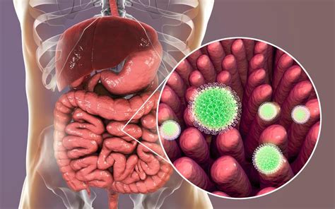 Infectia Cu Rotavirus Cauze Manifestari Si Optiuni De Tratament Dr Max