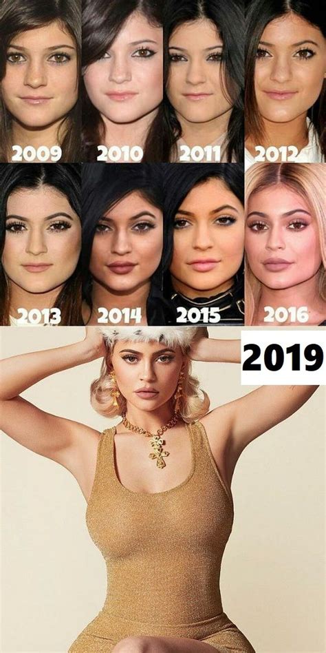 Kylie Jenner Then And Now Stunning Beauty Evolution Kyliejenner Kylie Jenner Celebrities
